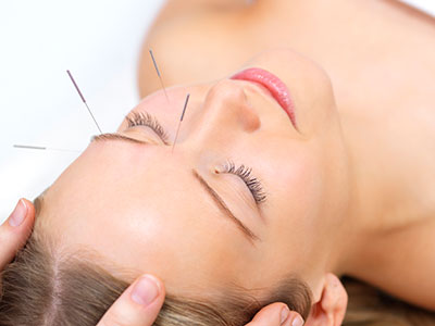 Acupuncture in Preston