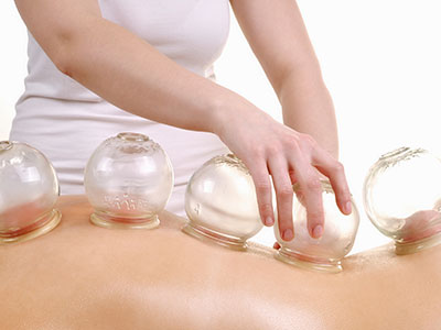 Acupuncture in Preston